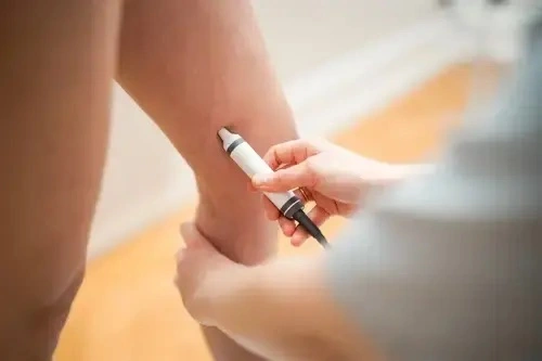 phlebologie in Hamburg