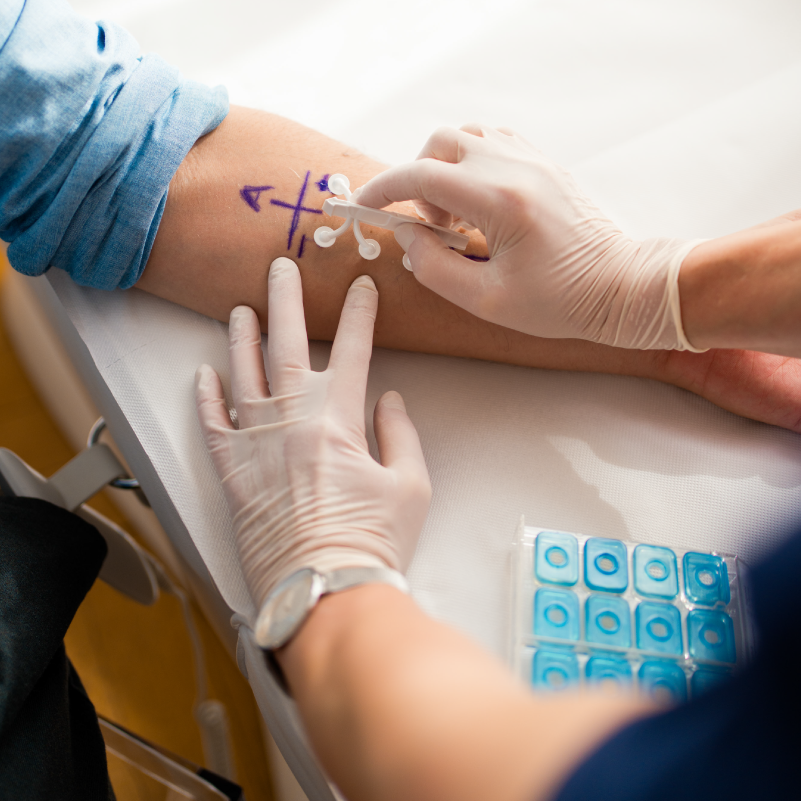 Allergien – Heuschnupfen, Asthma,Nesselsucht und mehr in Hamburg- Harvestude