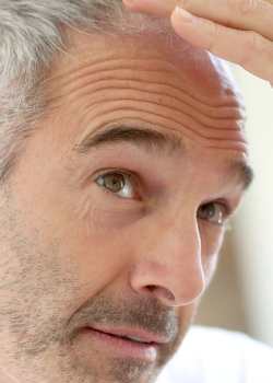 Haarausfall- und Kopfhauterkrankungen