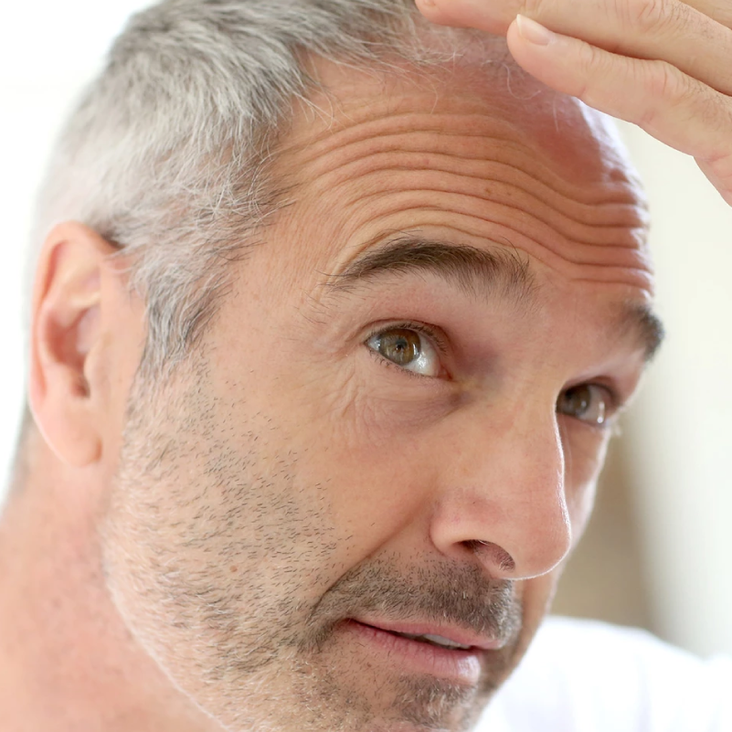 Haarsprechstunde Hamburg | Beratung bei Haarausfall