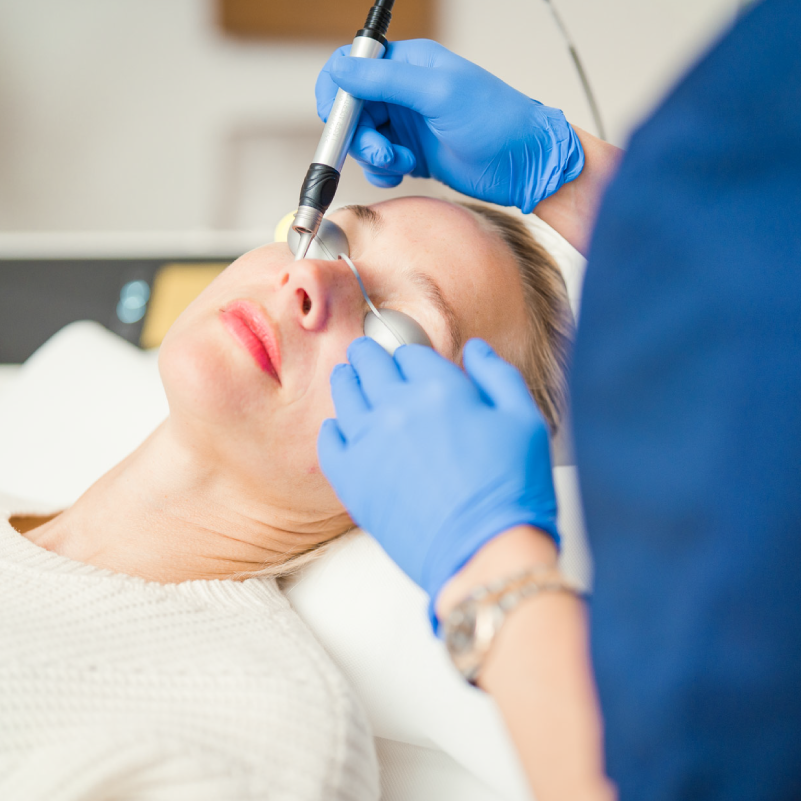 Mikrodermabrasion – Intensives Diamantpeeling für feinporige und glattere Haut