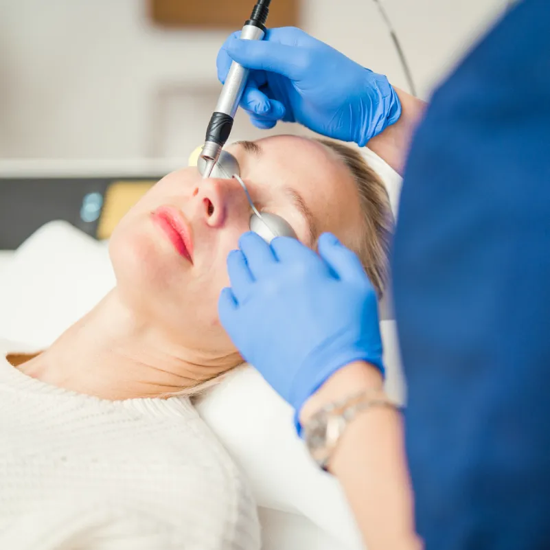 Mikrodermabrasion Hamburg als intensives Diamantpeeling für glattere Haut