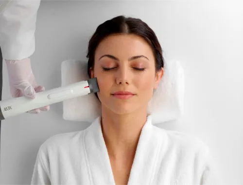XERF® Behandlung in Hamburg – Radiofrequenz-Hautstraffung an der Wange einer Patientin